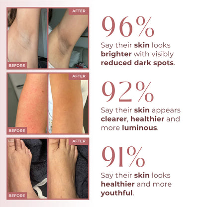 Seogul Peel Shot - Kojic + Turmeric Body Peel Spray