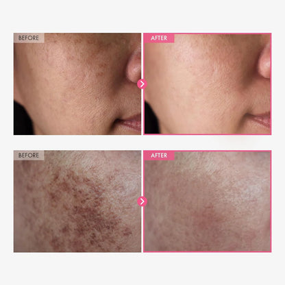 Korean Advanced Brightening Cream