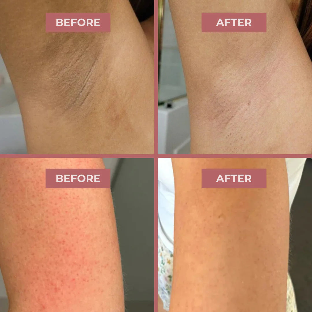 Seogul Peel Shot - Kojic + Turmeric Body Peel Spray