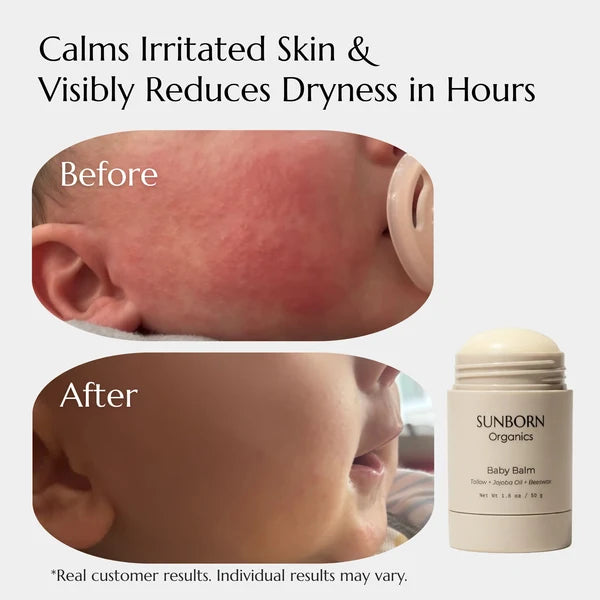 Baby Balm