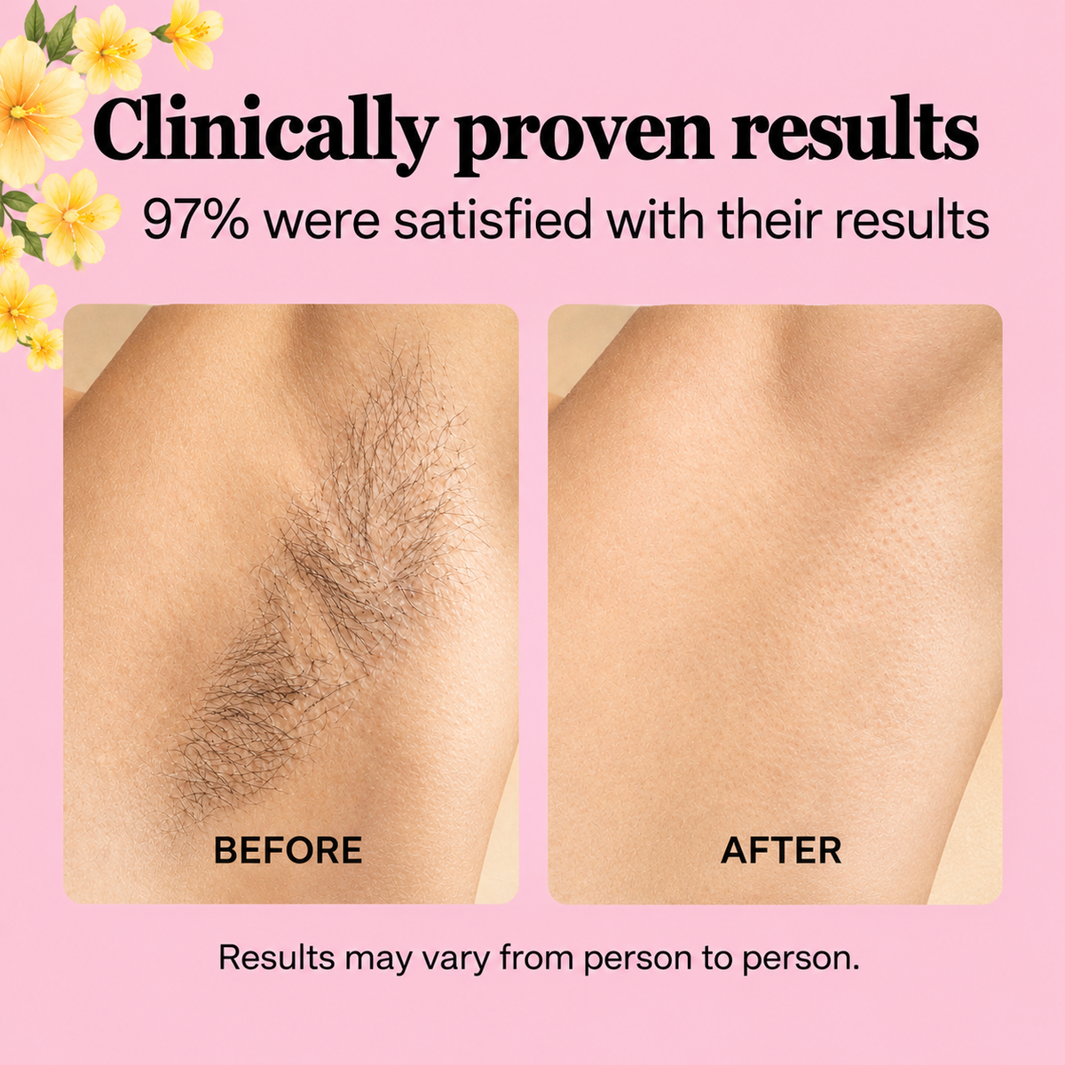 BarEssence Hair Removal Oil