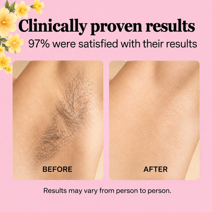 BarEssence Hair Removal Oil