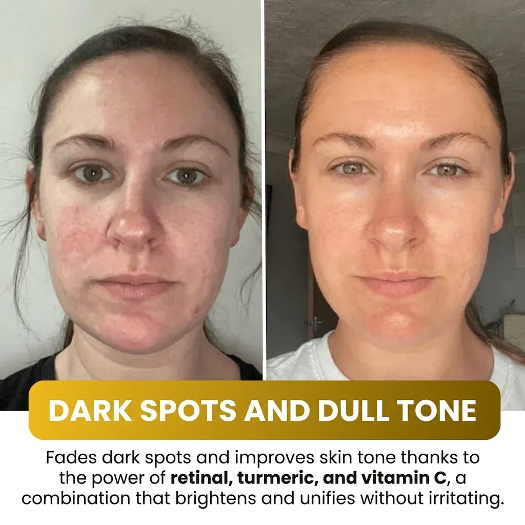 Kojic Acid Turmeric Overnight Mask