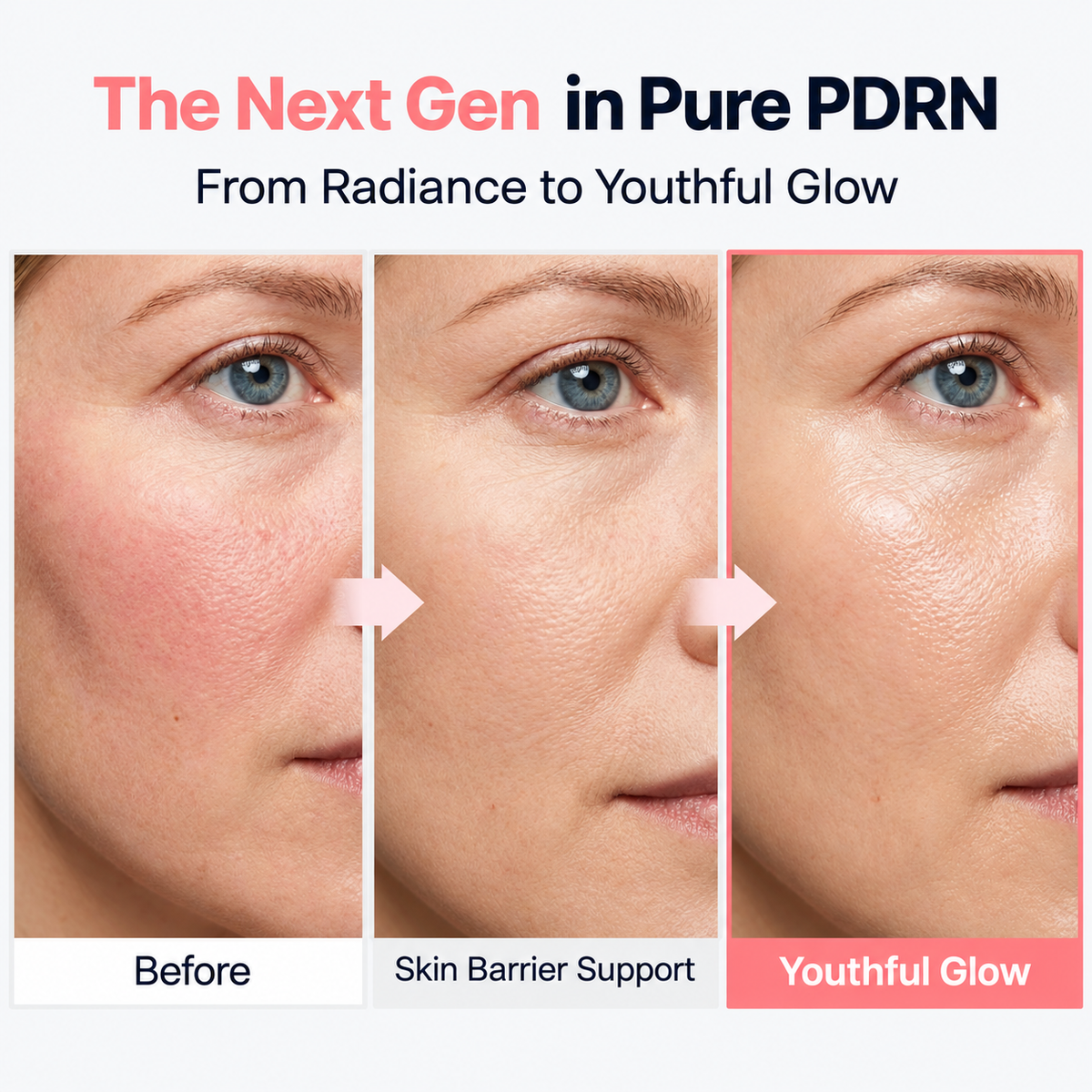Korean Silk PDRN Vitamin Ampoule